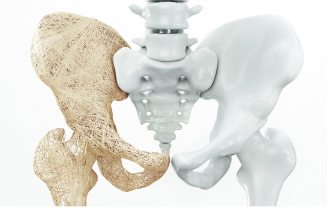 Comment préserver votre capital osseux ?